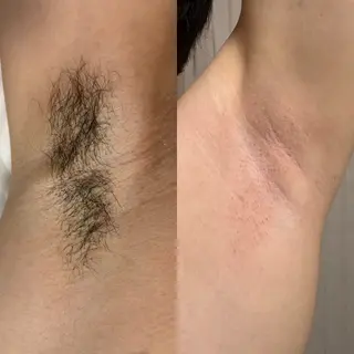 高槻駅近/脱毛サロン【Salon Repo】所属・加代 結愛のエステ・リラクイメージ