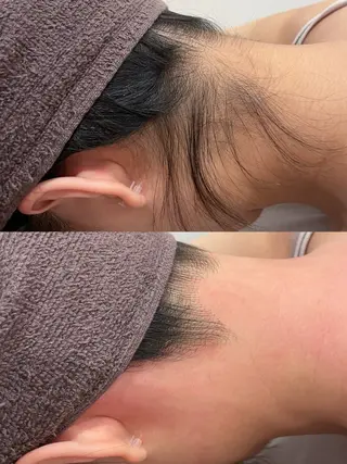 VIO脱毛専門店　kika〜キカ〜所属・【メンズSTART】 VIO専門店kikaのエステ・リラクイメージ