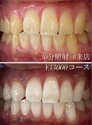 ホワイトニングルーム　川崎店所属・ホワイトニング ルーム　川崎店のその他イメージ