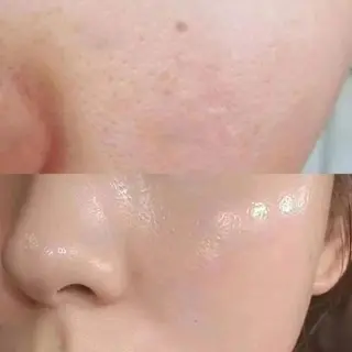 マツエク・マツパ aliaハイフ&水光ジェットサロン所属・aliaハーブ水光店 エステティシャン募集のエステ・リラクイメージ