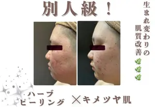 🎀美肌ケアサロン 🎀レイビス銀座店のエステ・リラクイメージ