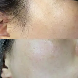 眉毛と韓国肌質改善 サロン　和泉府中のエステ・リラクイメージ