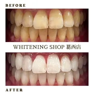 メンズ ホワイトニング ショップ葛西店のその他イメージ