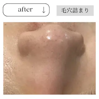 ICHOOSE/ 代々木上原のエステ・リラクイメージ