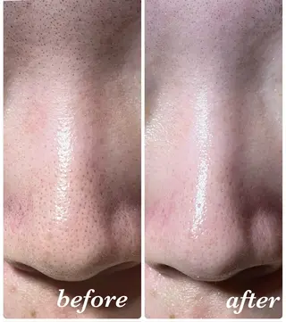 結果重視｜毛穴エステ ｜友綱理恵のエステ・リラクイメージ