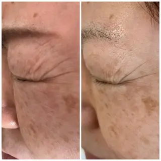 ポーラザビューティー 松原店のエステ・リラクイメージ