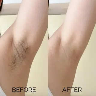 脱毛×肌管理サロン ルネルのエステ・リラクイメージ