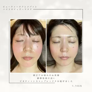 代表 MOMOのエステ・リラクイメージ