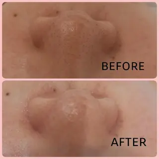 ナリスビューティーステーションDe I'm岡山所属・小野 恵のエステ・リラクイメージ