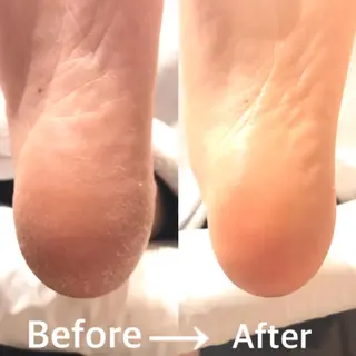 ネイル ブレスネイル 長谷川のネイルデザイン