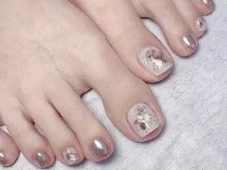 ネイル フィルイン、長さ出し 深爪矯正のネイルデザイン