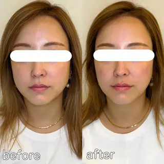 小顔矯正&美容整体 整え屋REDオーナーのエステ・リラクイメージ