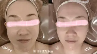 西区九条エステ MITUREIサロンのエステ・リラクイメージ