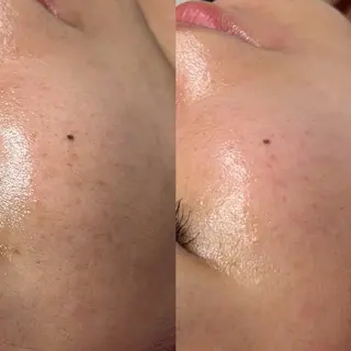 IRIS🫧 Ayaのマツエク・マツパデザイン