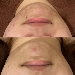 触れたくなる モテ肌へ...❤︎のエステ・リラクイメージ