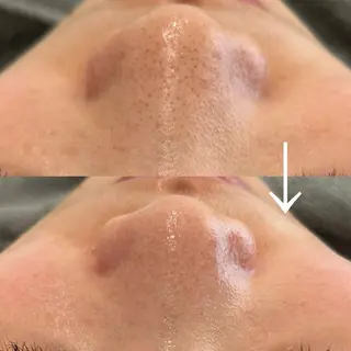 カンナムビューティー麻布十番店所属・bizz bizz 麻布十番🌿のその他イメージ