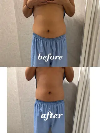 メンズ 腸活サポート みなみののエステ・リラクイメージ