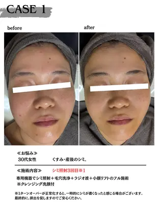 素肌育成・シミケア専門サロン美潤-miulu-所属・【医療提携サロン】 【シミケア専門】のエステ・リラクイメージ