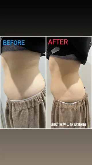 アルカンジュ~archange~所属・痩身/毛穴洗浄/脱毛 アルカンジュのエステ・リラクイメージ