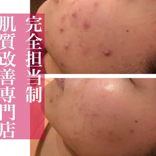 ミディアム カラー パーマ ヘアアレンジ メンズ キッズ ネイル マツエク・マツパ ニキビ・肌質改善専門 ♡人生が変わるサロンのエステ・リラクイメージ