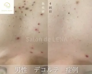 サロンドレナ名駅店所属・ハーブピーリング専門 サロンドレナ平岡のエステ・リラクイメージ