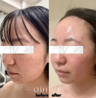 aimer 島田のエステ・リラクイメージ