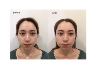 アイブロウ Tommy所属・Tommy. MIZUKIの眉毛・アイブロウイメージ