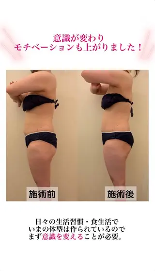 産後ダイエット−9㎏ Pourvous結衣のエステ・リラクイメージ