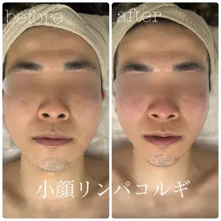 メンズ フェイシャルサロン CHIARA 荒田のエステ・リラクイメージ