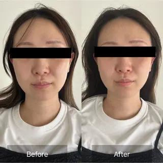 Radiance H.Oのエステ・リラクイメージ