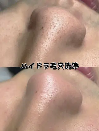 美BELLO 池袋のエステ・リラクイメージ