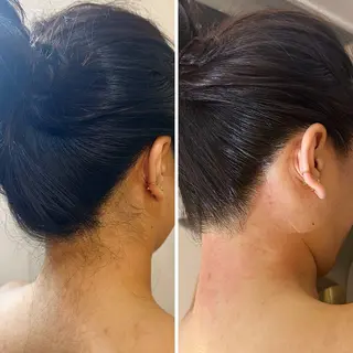 うなじ脱毛/美肌脱毛 LABELのエステ・リラクイメージ