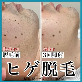 メンズ TSUBAKI上尾店所属・TSUBAKI上尾店 松下のエステ・リラクイメージ