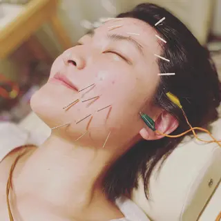 むくみたるみ専門☆ 美容鍼・小顔矯正のエステ・リラクイメージ