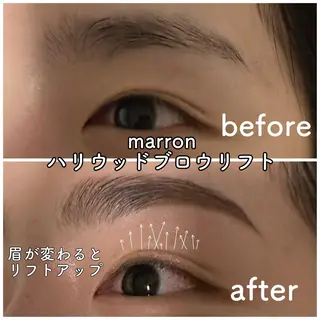 marron所属・痩身ハイパーナイフ ララピールリアボーテのエステ・リラクイメージ