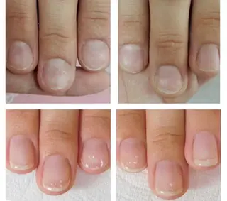 ネイル hana.nail 自爪育成サロンのネイルデザイン