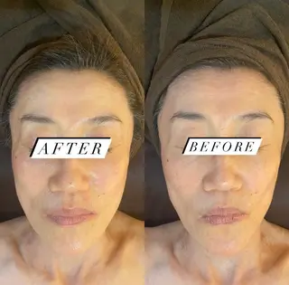 BELCIA福岡店　récolte de BELCIA（レコルトデベルシア）所属・BELCIA福岡店 レコルトデベルシアのエステ・リラクイメージ