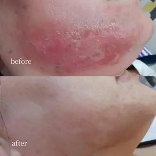 韓国肌管理・肌質改善 EARNEST心斎橋のエステ・リラクイメージ