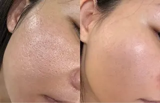 カラー 愛維美水光美肌専門店所属・愛維美水光美肌専門店 メンズレディースokのエステ・リラクイメージ