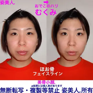 筋膜整体＆小顔矯正 　姿美人.シルエットのエステ・リラクイメージ