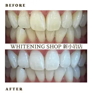 メンズ ホワイトニング ショップ新小岩店のその他イメージ