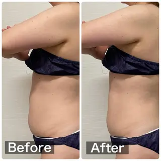 beauty salon  SUKOBI所属・ﾋﾞｭｰﾃｨｻﾛﾝ SUKOBIのエステ・リラクイメージ