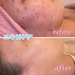 3glitter 肌質改善＆痩身のエステ・リラクイメージ