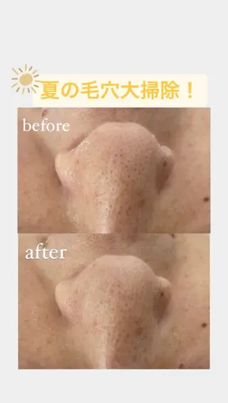 CSサロン Amule所属・🦋肌質改善サロン. anna🦋のエステ・リラクイメージ