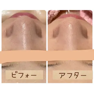 【前橋市】毛穴洗浄× オールハンドリンパのエステ・リラクイメージ