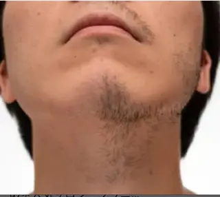 メンズ charmant (シャルマン)所属・エステサロン charmantのエステ・リラクイメージ