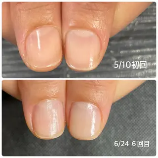 ネイル 奥園 良恵のネイルデザイン