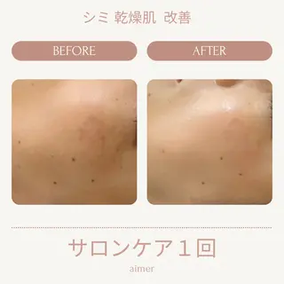 aimer beautyのエステ・リラクイメージ