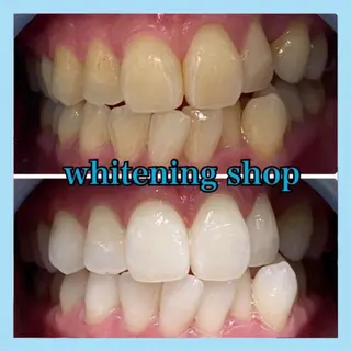 ホワイトニング ショップ千葉店のその他イメージ