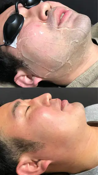 メンズ Lilyboo 池袋のエステ・リラクイメージ